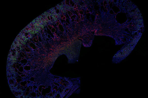 genetica genetica