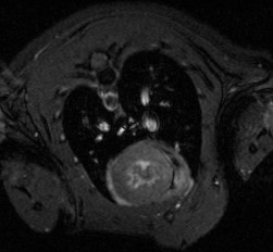 AC25 – Radiología