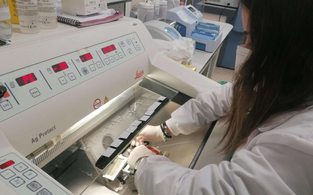 La spin off del IDIS, Lincbiotech, lidera un proyecto financiado por el European Innovation Council para desarrollar moléculas que frenen enfermedades graves.